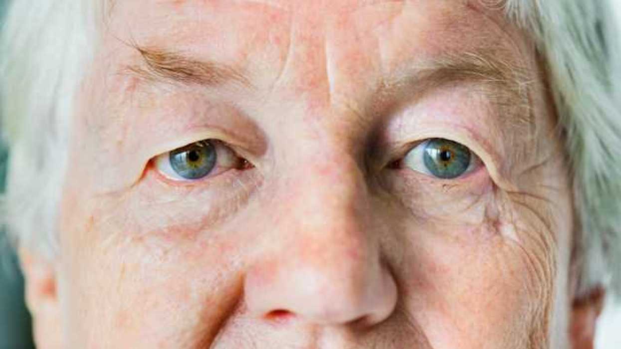A closeup of an older person's face including their eyes