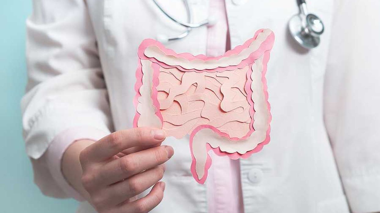 A doctor holding a paper model of the intestines