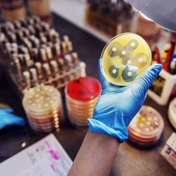 A gloved hand holding a petri dish