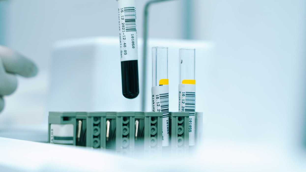 a gloved hand holding a test tube filled with liquid