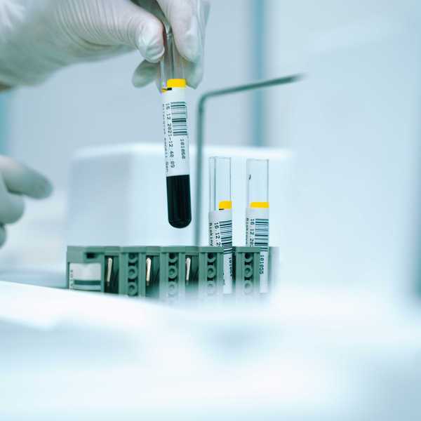 a gloved hand holding a test tube filled with liquid