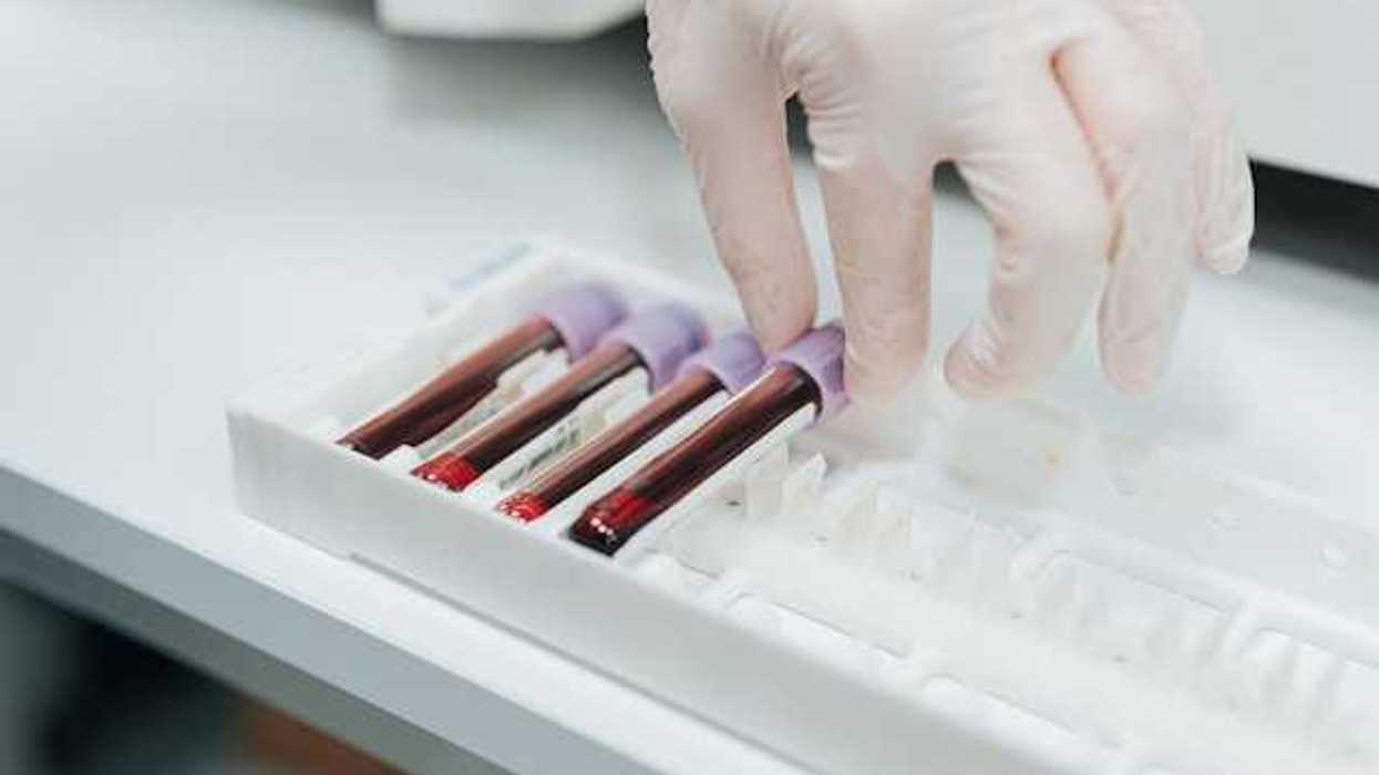 A gloved hand putting a vial of blood into a container