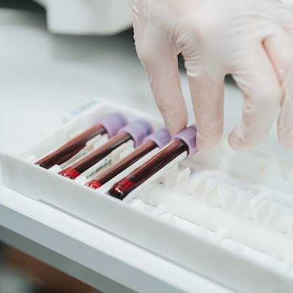 'Forever chemicals' found in 98.8% of human blood samples tested