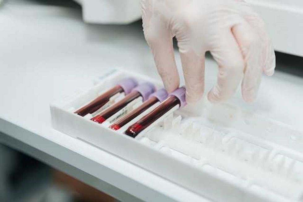 'Forever chemicals' found in 98.8% of human blood samples tested
