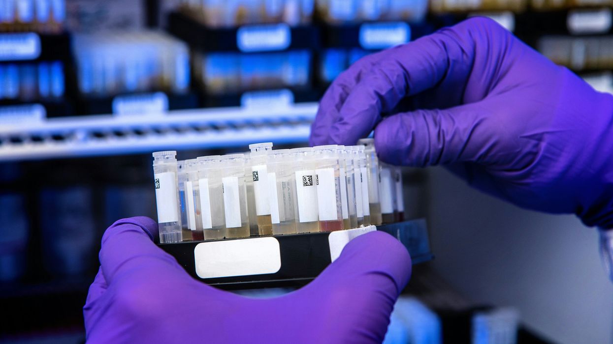 A lab technician runs a chemical test