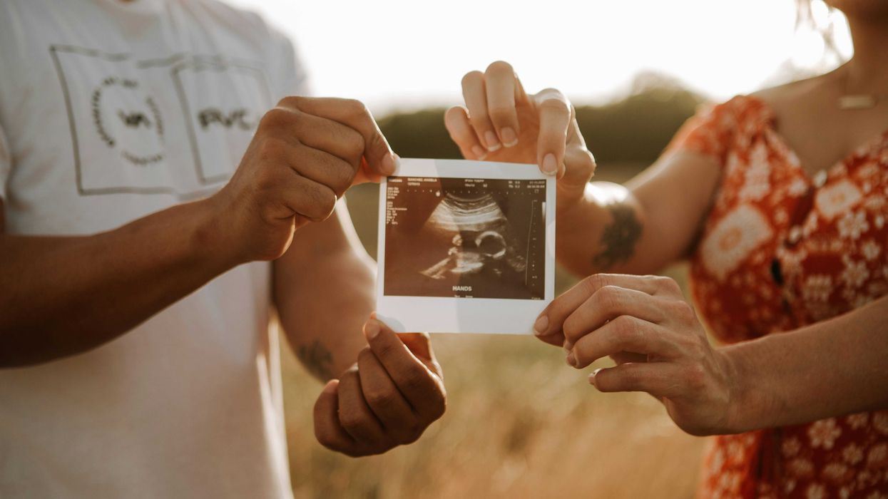 A man and a woman holding an ultrasound image of a fetus.