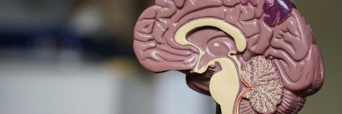 a medical model of the human brain