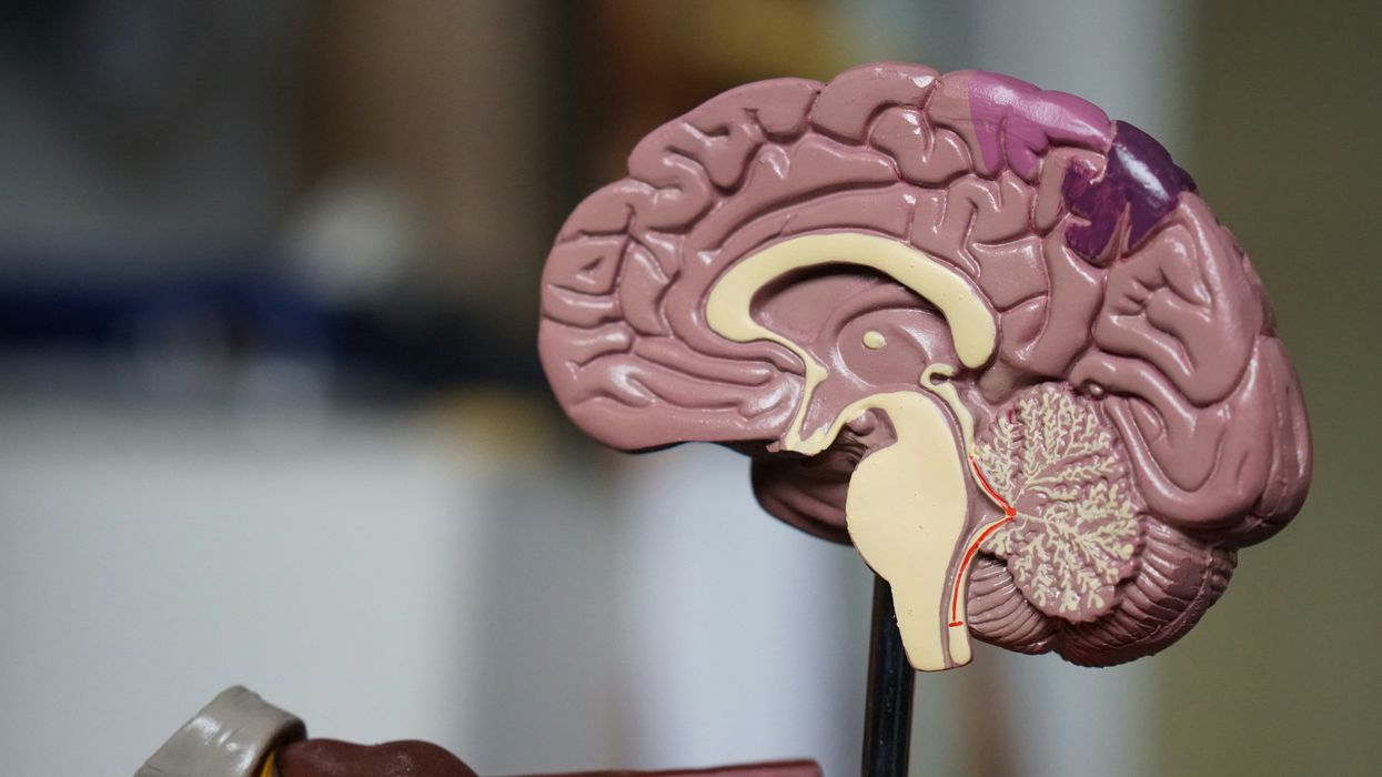a medical model of the human brain