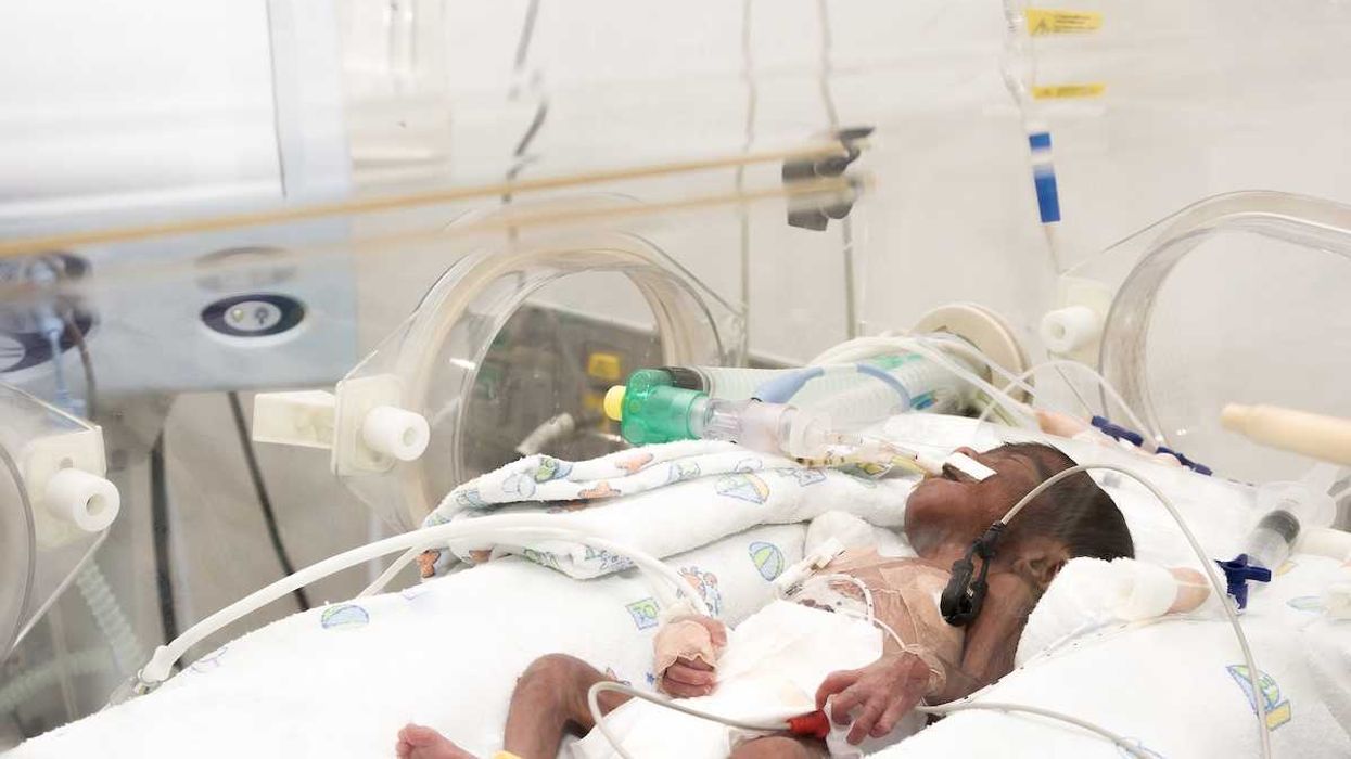 A newborn baby, intubated with multiple IV lines, sleeping inside incubator.