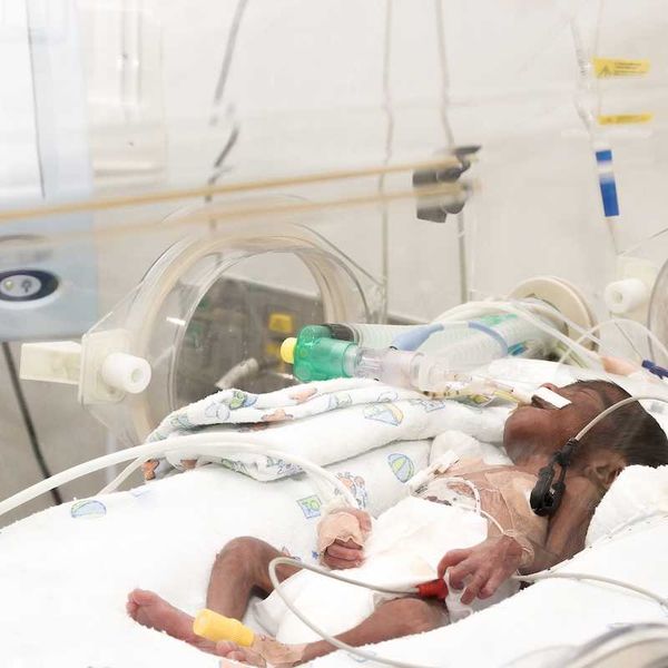 A newborn baby, intubated with multiple IV lines, sleeping inside incubator.