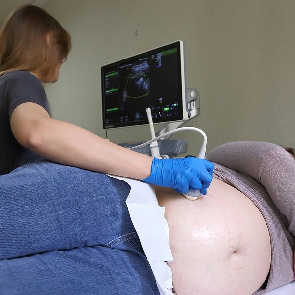 A nurse performs an ultrasound