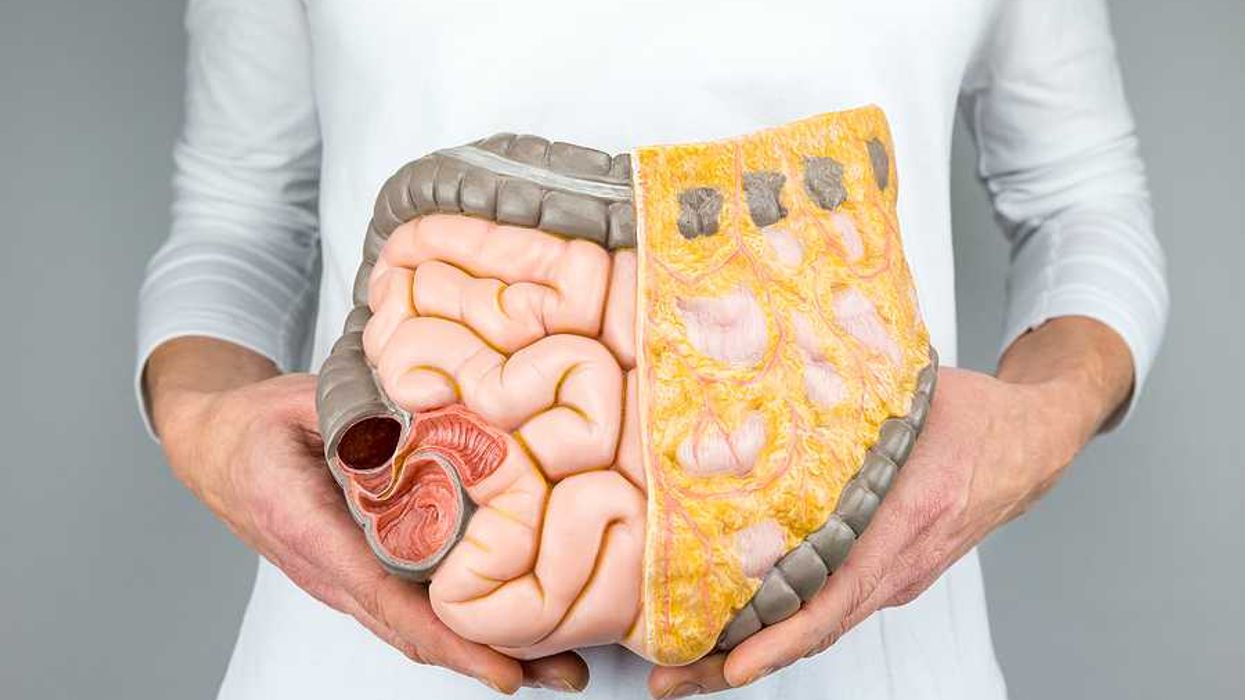 A person holding a plastic replica of the human intestinal system