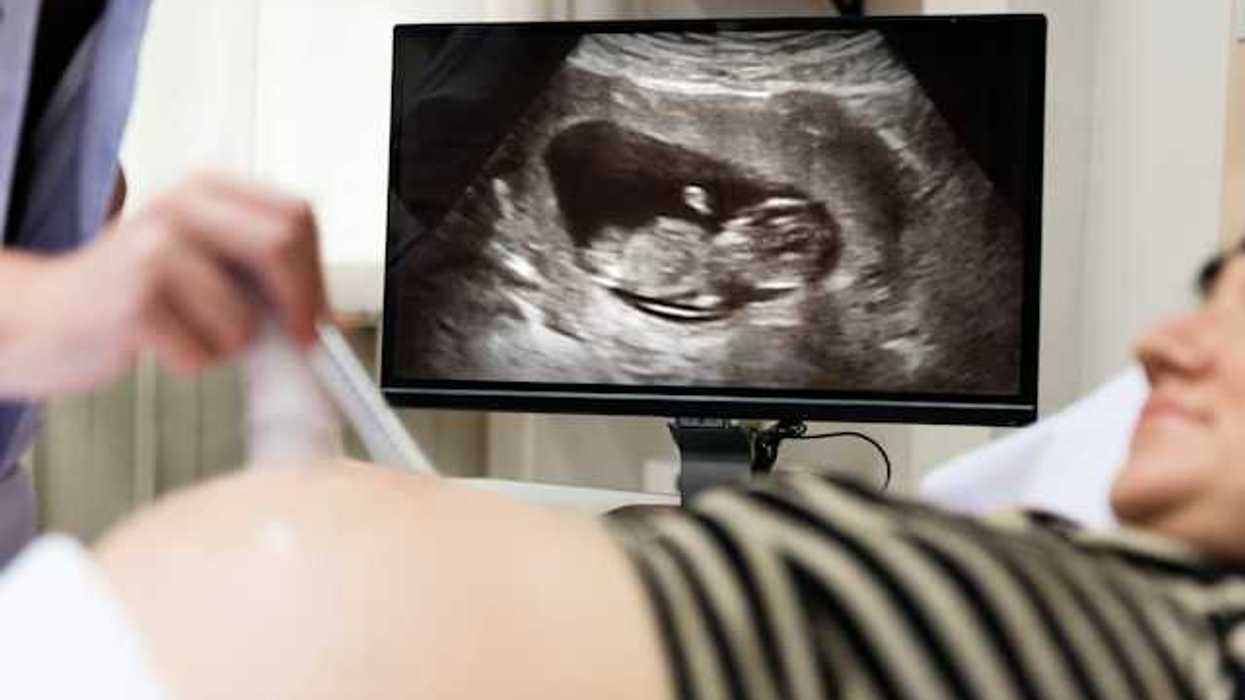A pregnant woman having an ultrasound with an image of the fetus to her right