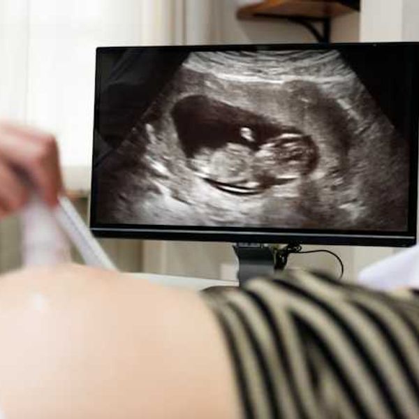 How forever chemicals may raise risks for pregnant women, fetuses