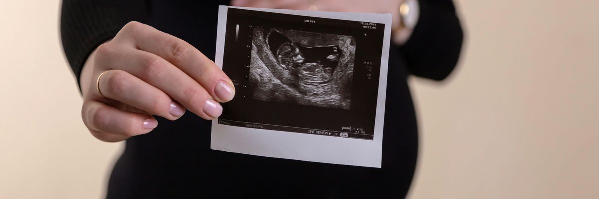 A pregnant woman holds an ultrasound image