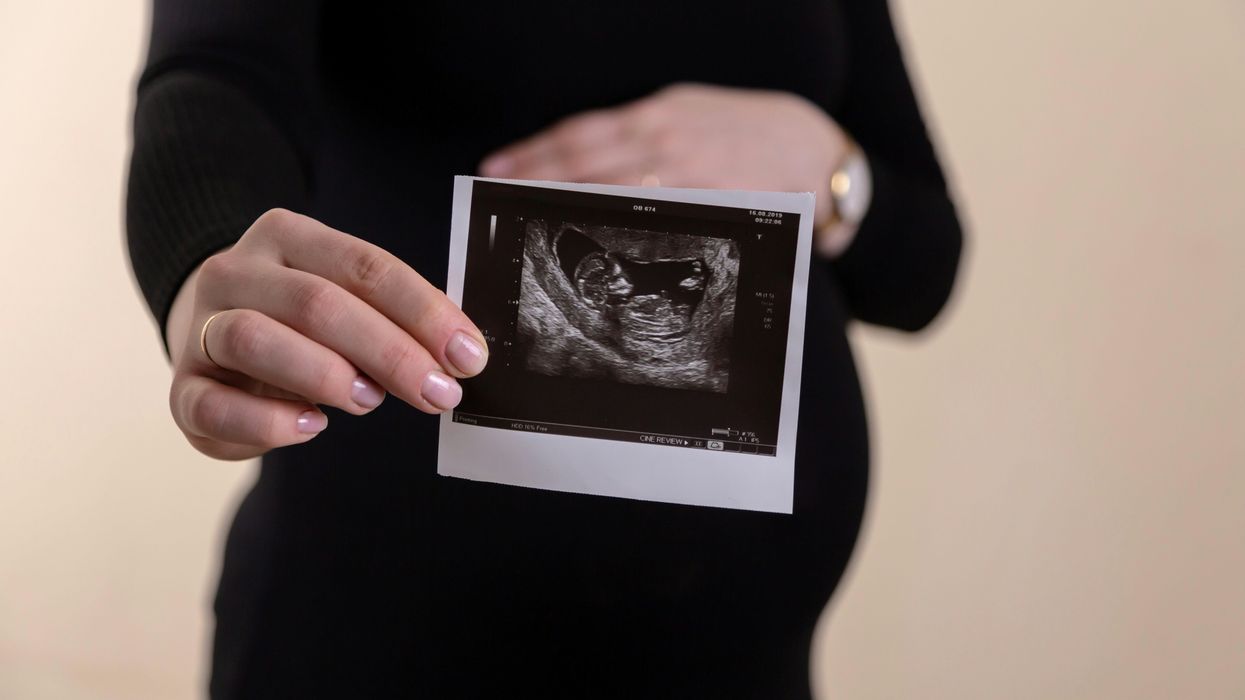 A pregnant woman holds an ultrasound image