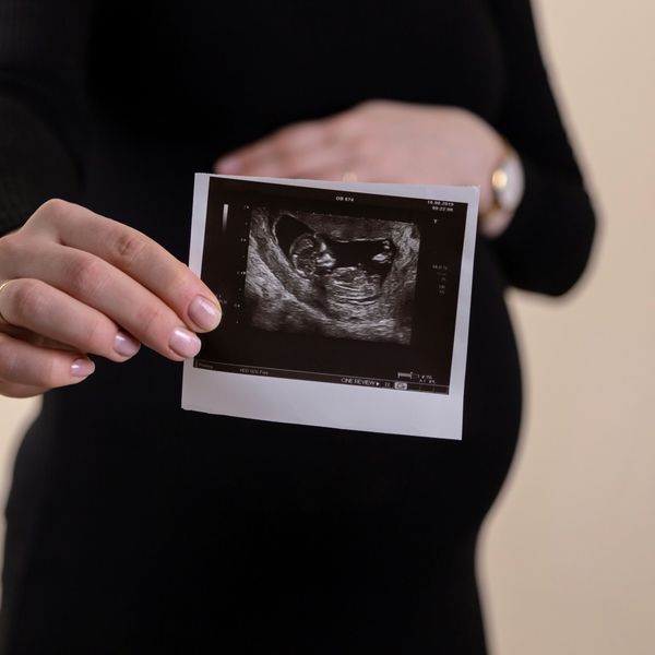 A pregnant woman holds an ultrasound image