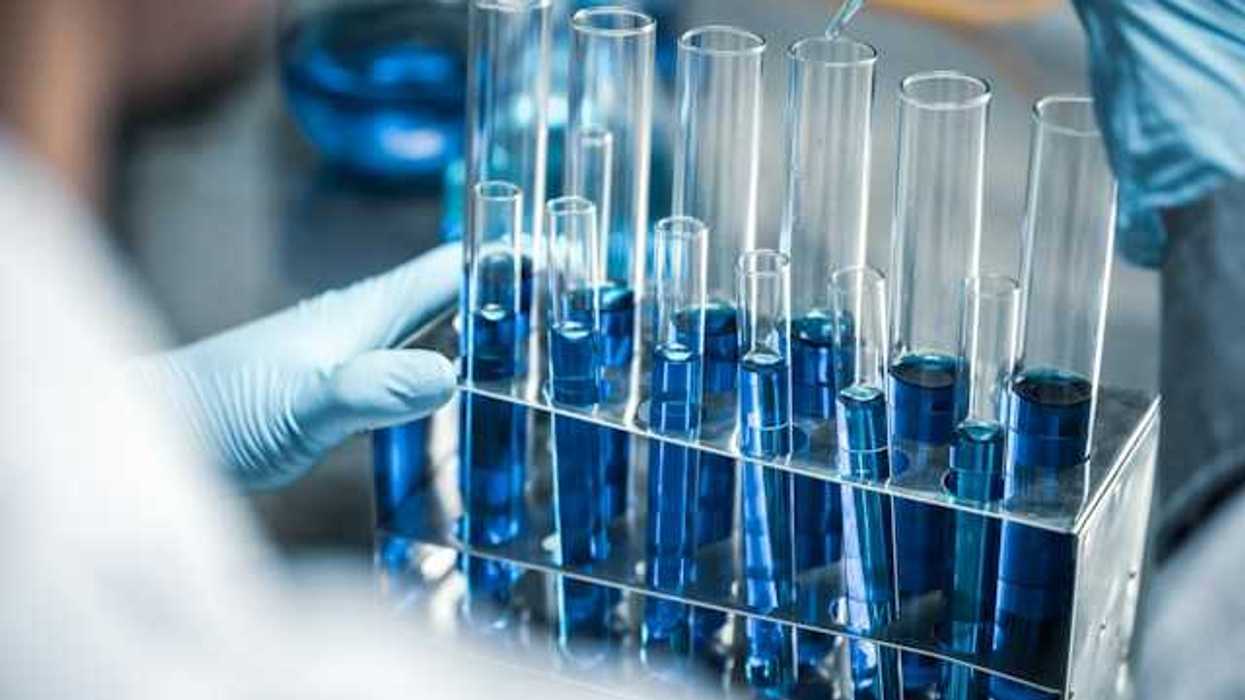 A rack of test tubes with blue liquid in them, with a lab worker using a dropper in one of them
