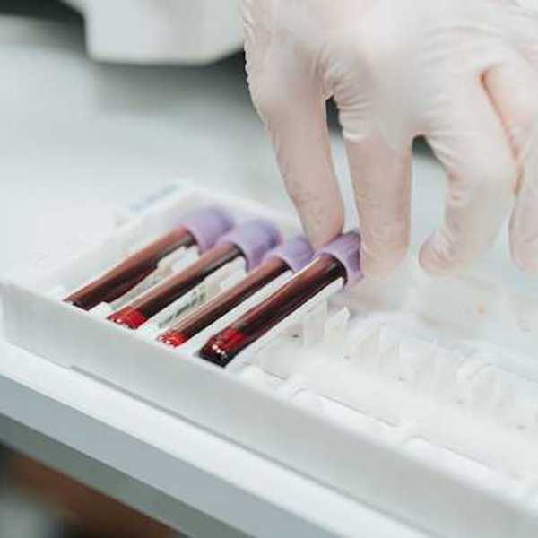 A row of vials filled with blood being handled by a gloved hand