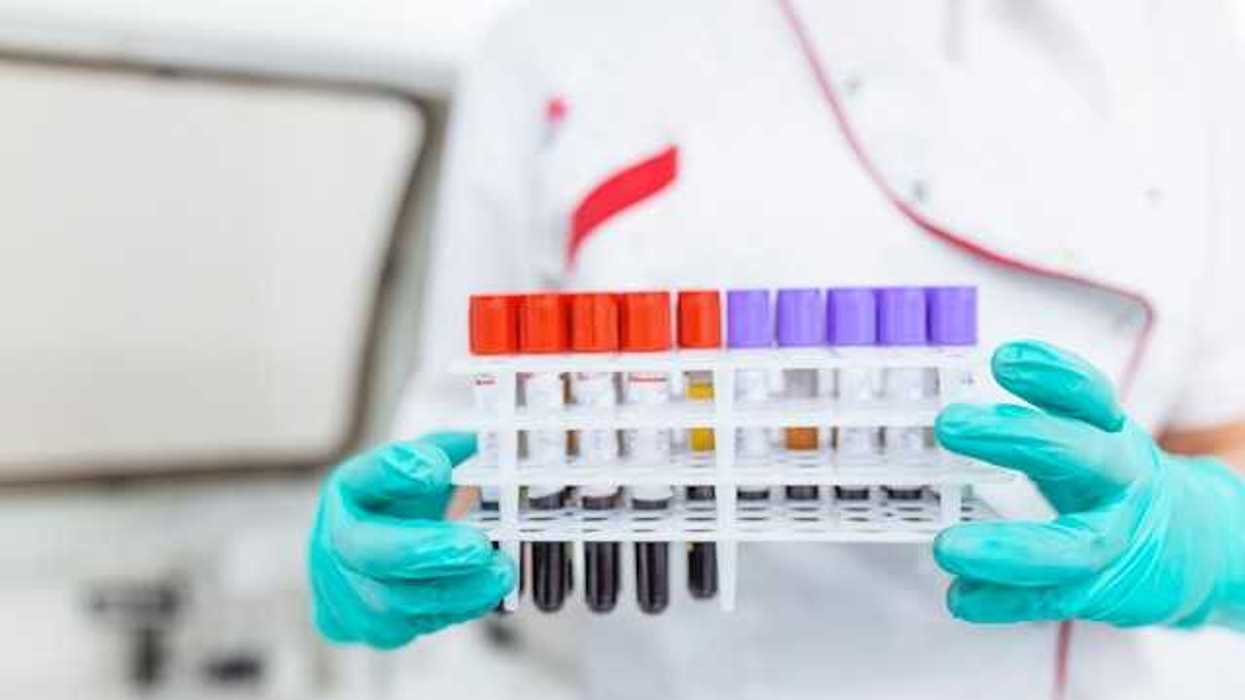 A scientist holding a tray full of blood samples in beakers