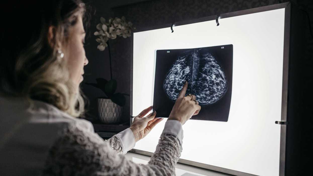 A woman examines the results of a mammogram