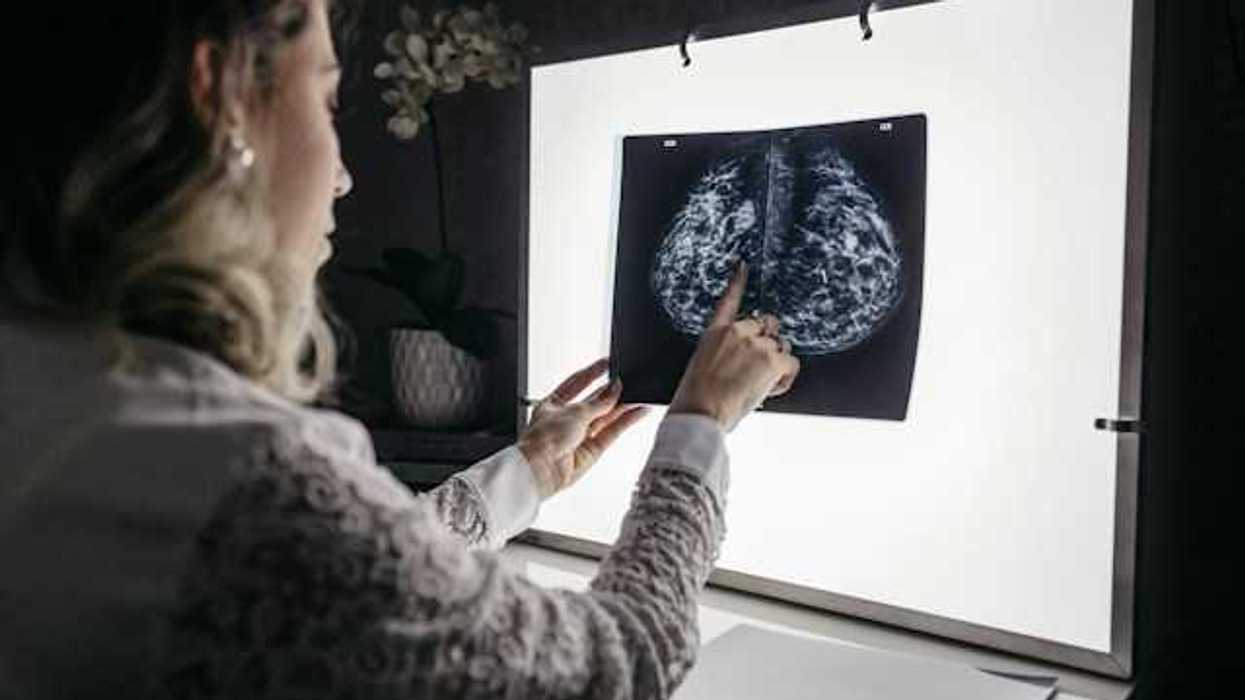 A woman looking at an xray of a breast