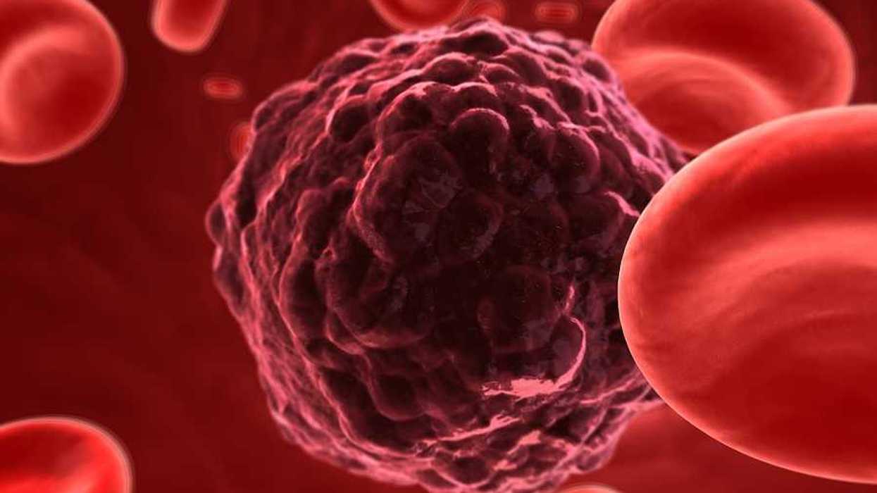 An illustration in red of a cancer cell surrounded by red blood cells