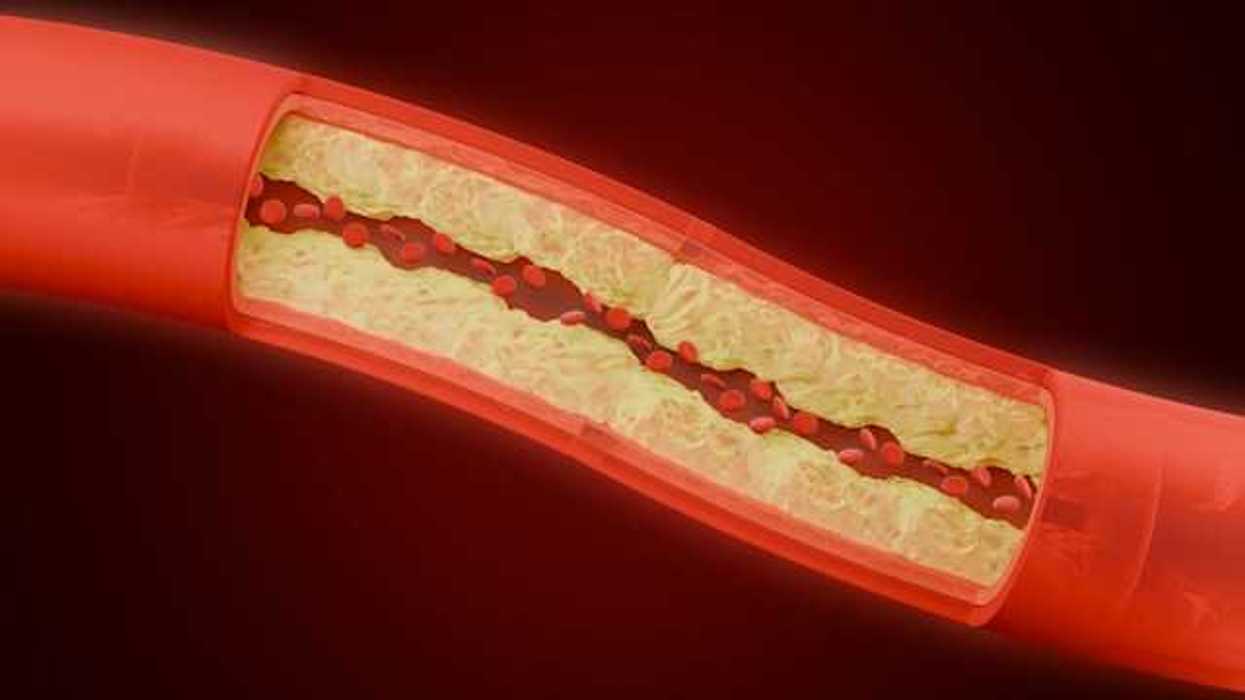 An illustration of a blood vessel showing the interior and exterior sections