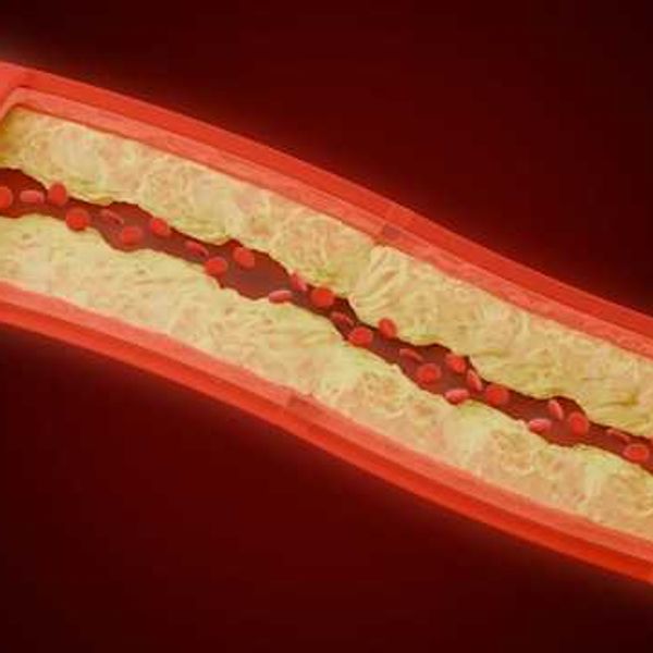 Small, abundant PFAS could impair blood vessel development