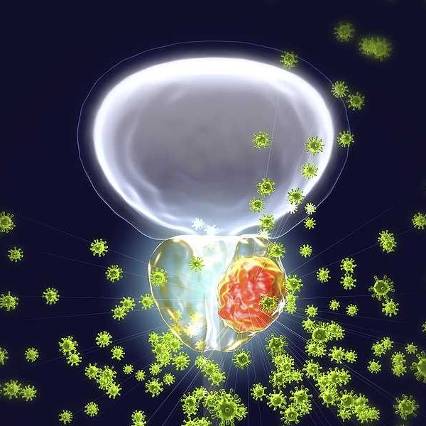 Microplastics found in prostate tumors in small study