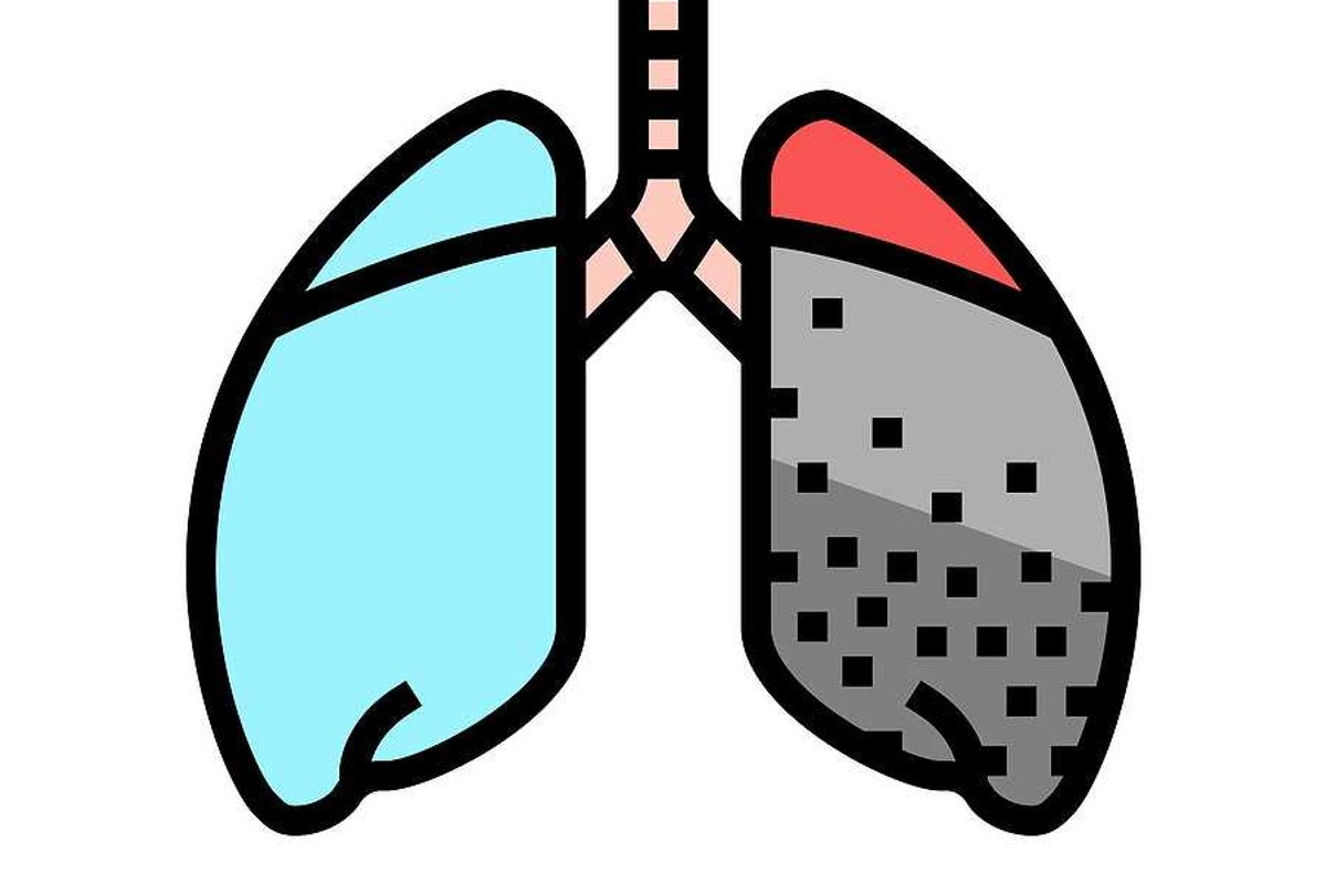 Appalachia's black lung rates highest in nearly 50 years as…