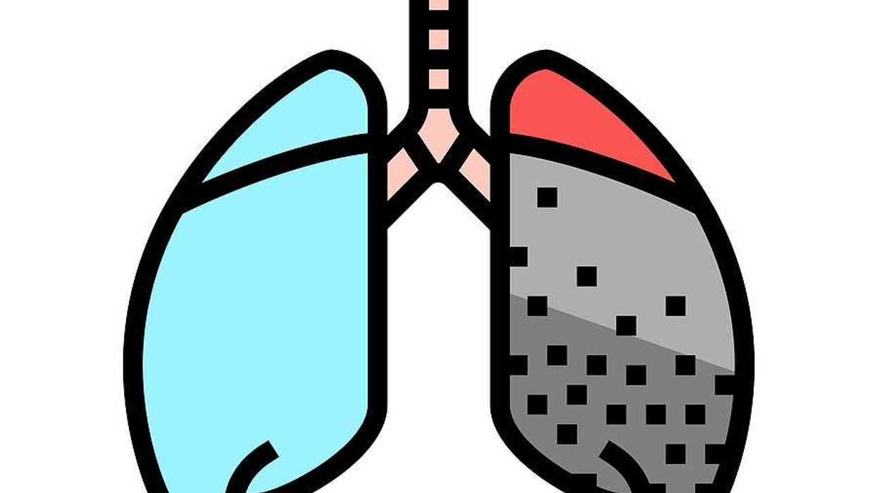 An illustration showing human lungs with one side healthy and the other black