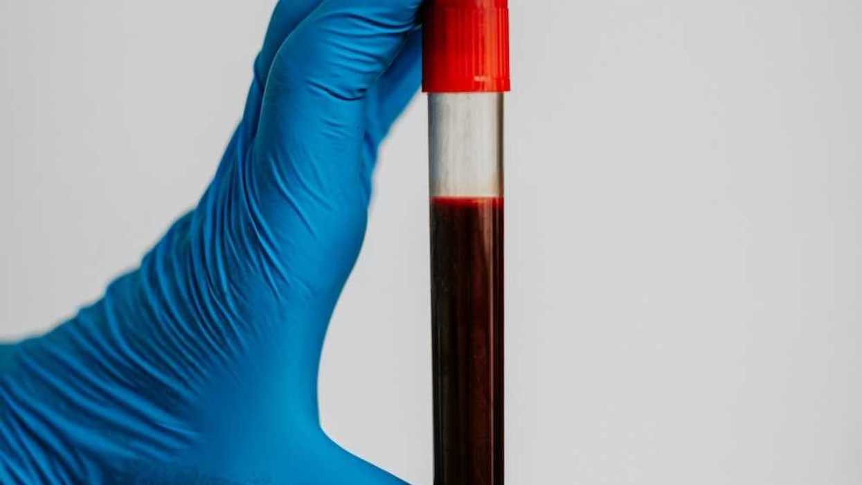 Blue-gloved hand displaying a blood-filled test tube