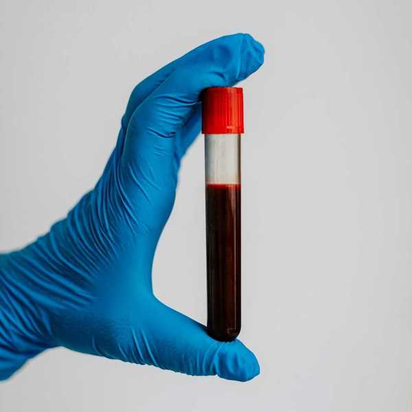 Blue-gloved hand displaying a blood-filled test tube