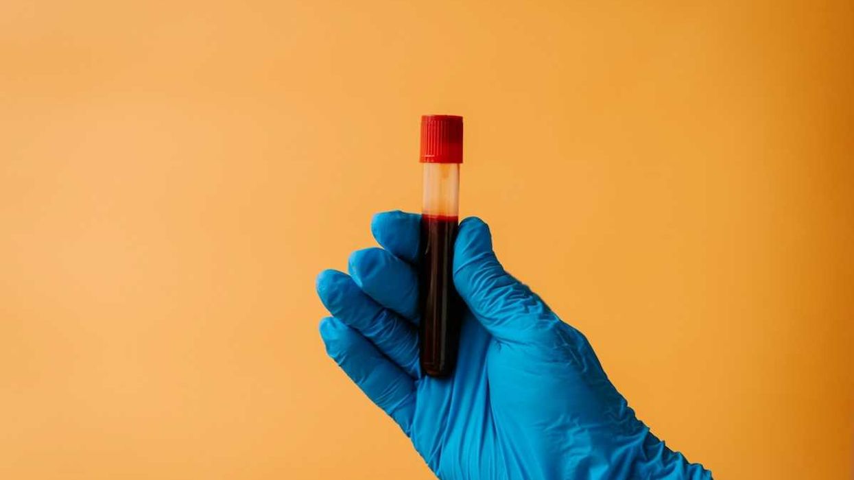 Blue-gloved hand holding a test tube with blood sample
