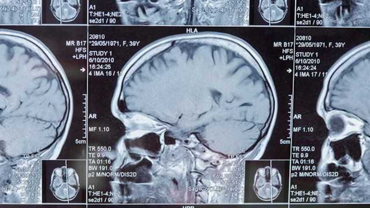 Closeup of a Magnetic Resonance Image (MRI)