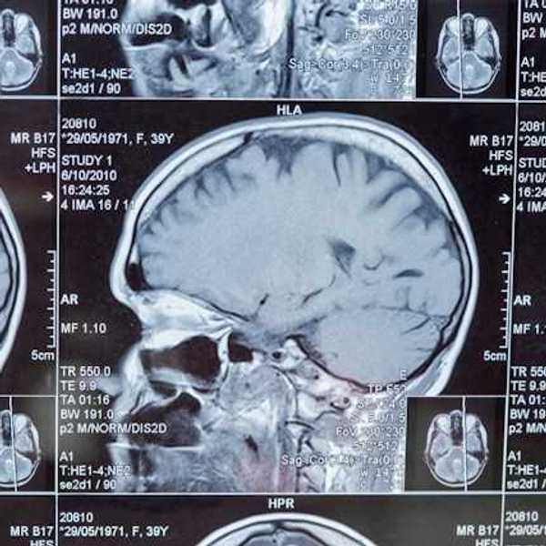 Closeup of a Magnetic Resonance Image (MRI)
