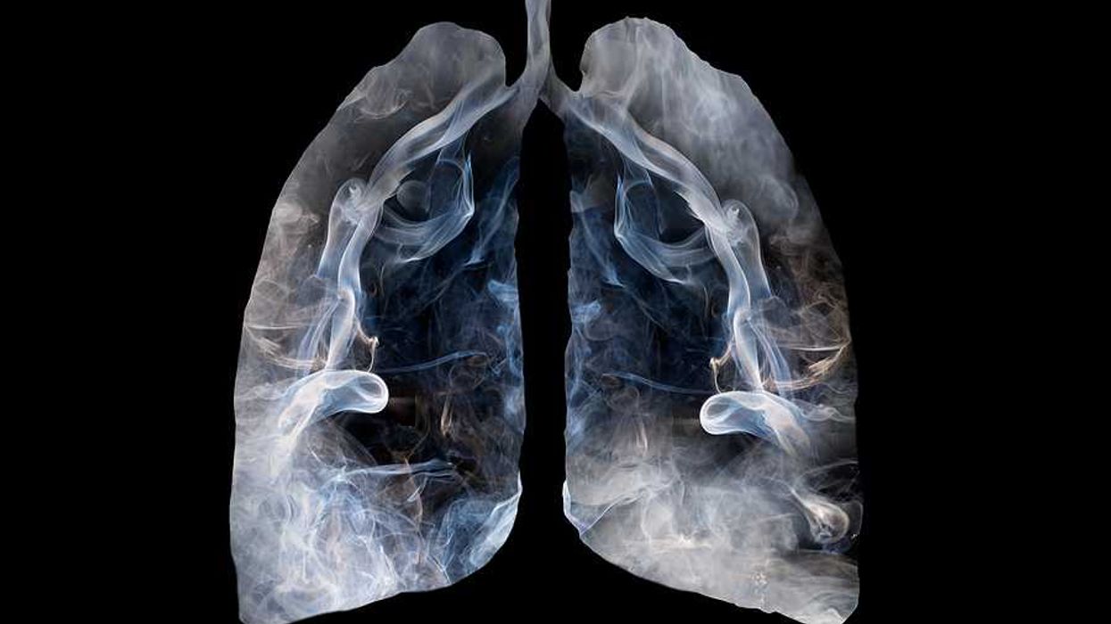 Illustration of a toxic smoke formation shaped as the human lung