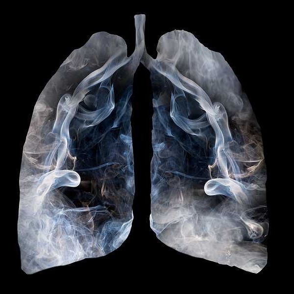 Illustration of a toxic smoke formation shaped as the human lung