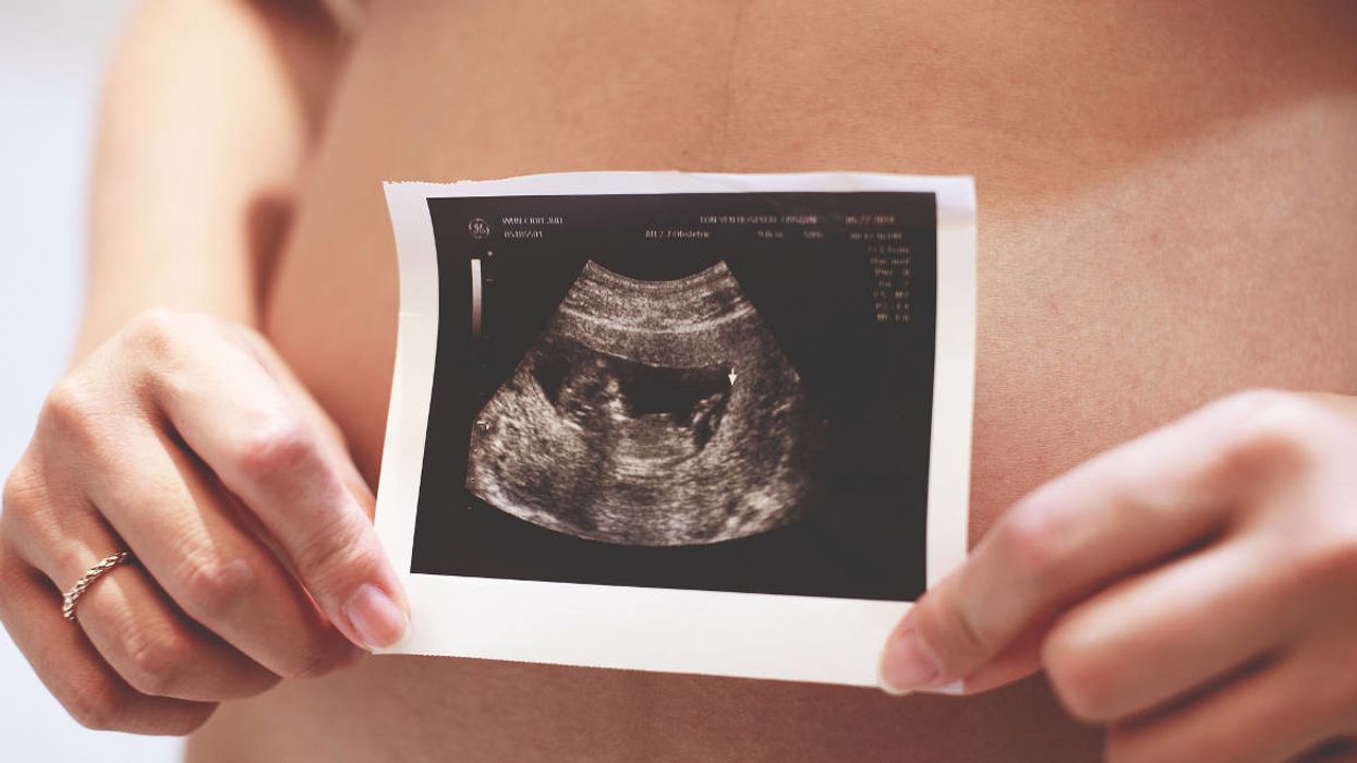 DDT linked to an increase in autism risk in new study