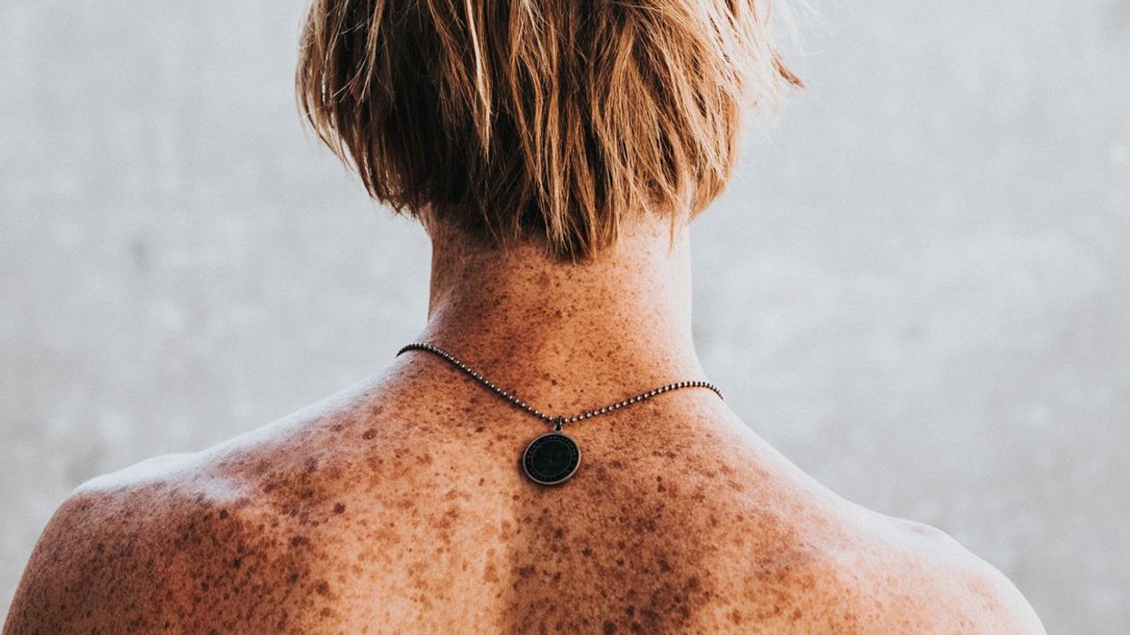 Essay: The plastic in our flesh