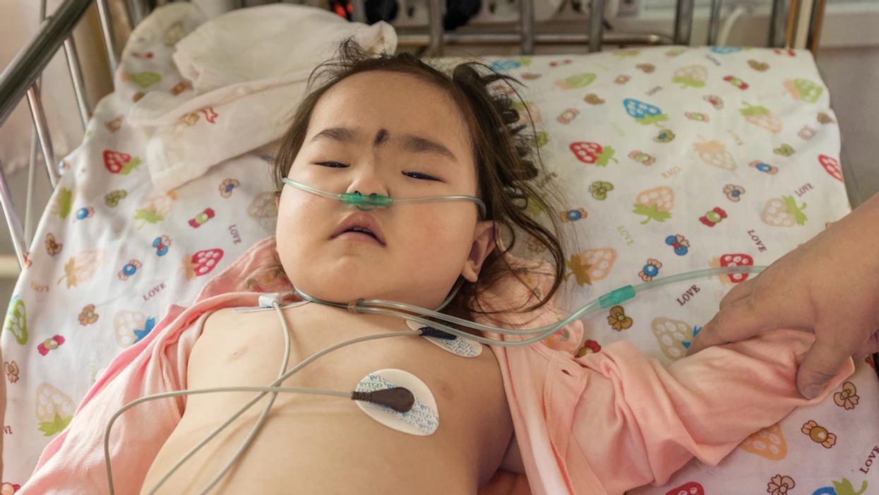 Air pollution kills millions every year, like a 'pandemic in slow motion'