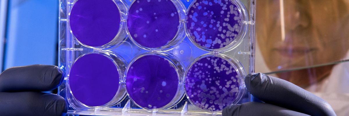 Lab technician examines bacteria colonies