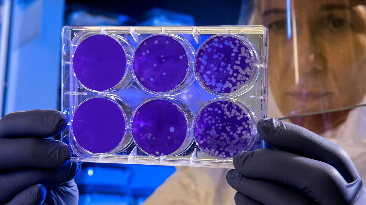 Lab technician examines bacteria colonies