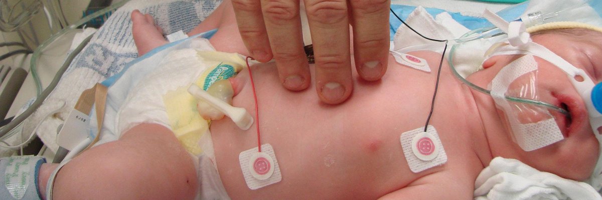 Neonatal intensive care phthalates DEHP medical devices
