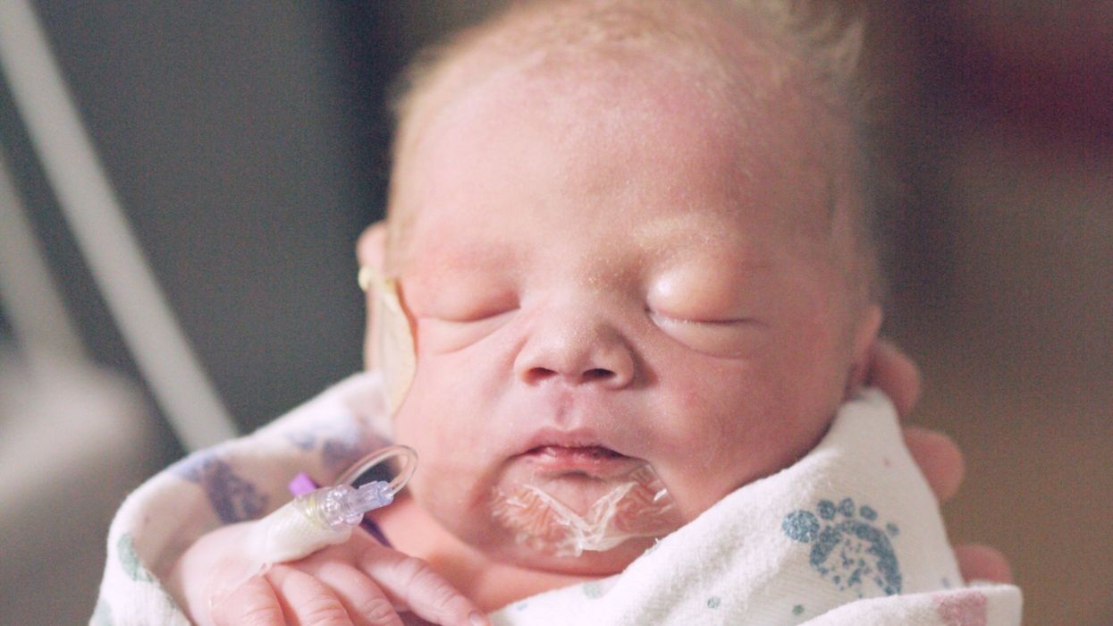 Exposure of preterm neonates receiving total parenteral nutrition to phthalates and its impact on neurodevelopment