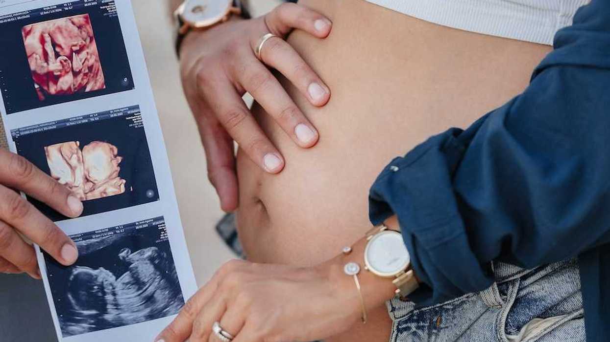pregnant couple holding photos of baby in utero