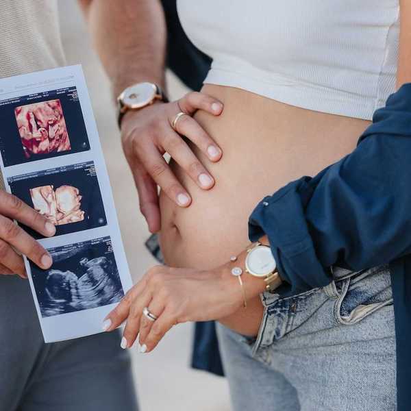 pregnant couple holding photos of baby in utero