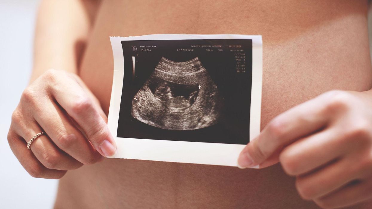 pregnant woman