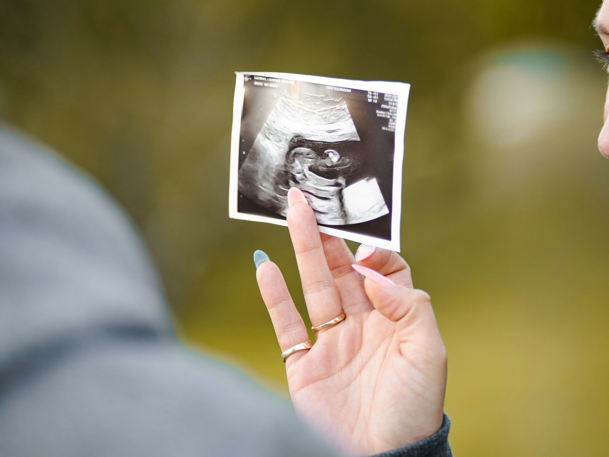 pregnant women health